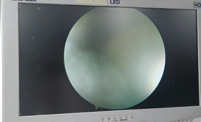 STRYKER關(guān)節(jié)鏡0502-104-030維修案例分析